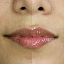 Cargar imagen en el visor de la galería, BLIP ARUBA